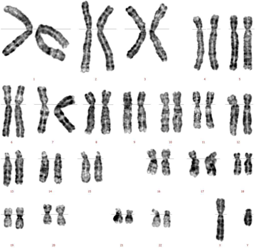 figure 2b